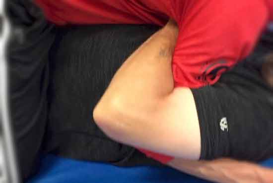 Overhook Above Elbow
